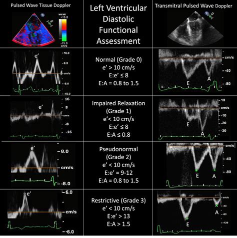 impaired lv diastolic function|unable to assess diastolic function.